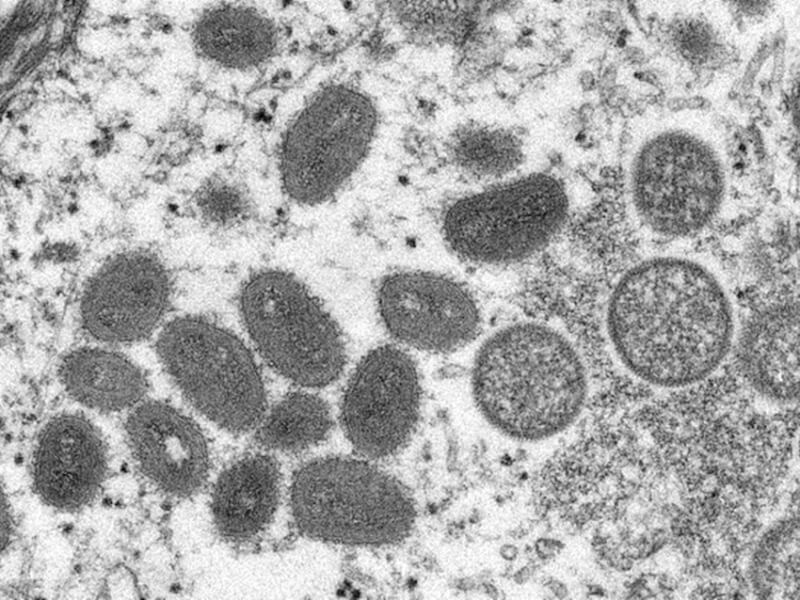 圖為猴痘病毒粒子。（圖取自美國疾病管制暨預防中心網頁cdc.gov）
