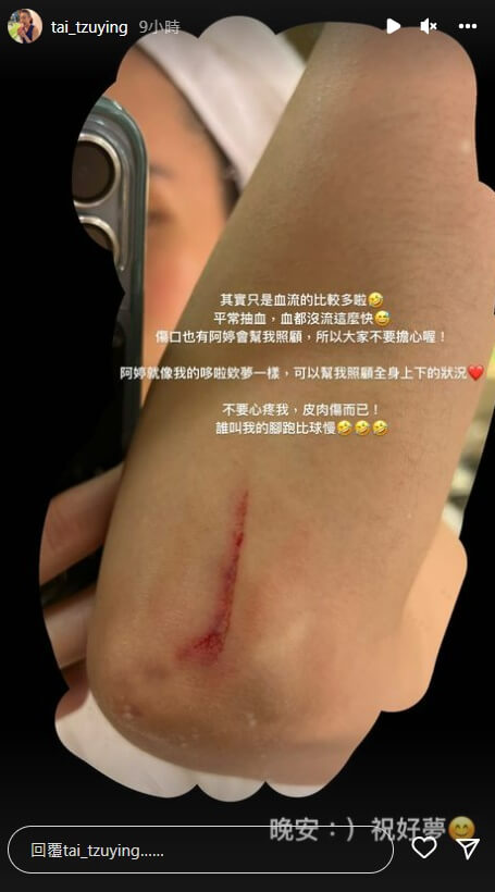 東京奧運羽球銀牌得主戴資穎3日在IG貼出傷口照，強調受傷不是輸球的藉口。（圖取自instagram.com/tai_tzuying）