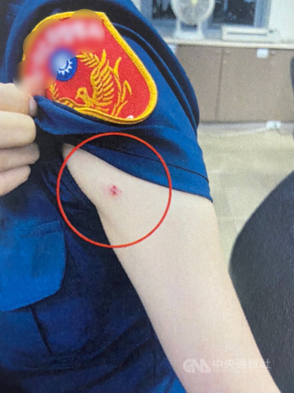 北市一名女子日前深夜向警方報案手機遺失,警方到場處理,發現女子渾身散發酒味且情緒激動,過程中女子辱罵員警、毀損警用秘錄器還咬傷女警(圖),警方依現行犯逮捕送辦。(翻攝照片)中央社記者黃麗芸傳真 111年7月13日
