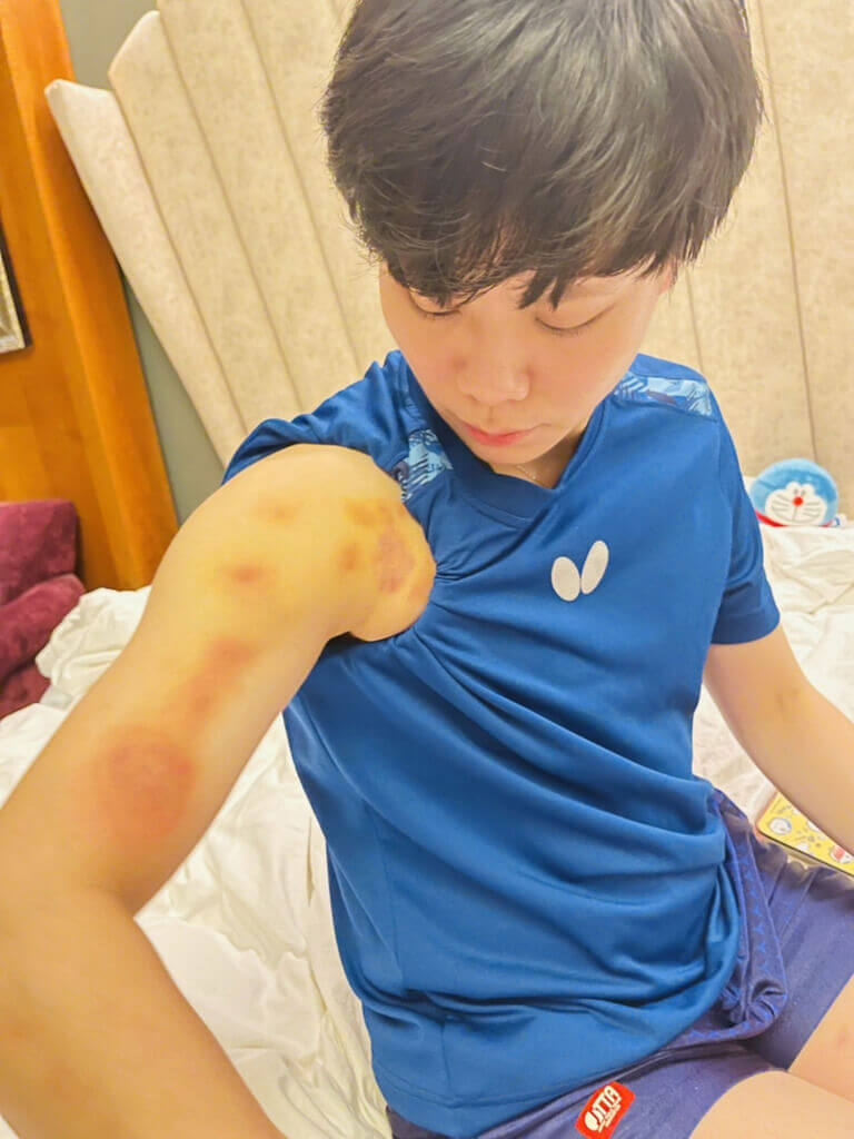 台灣桌球女將鄭怡靜在2022世界桌球團體錦標賽帶傷奮戰，打到腰傷復發，雙臂也出狀況，每次上場都吞2顆止痛藥。（鄭佳奇提供）中央社記者龍柏安傳真 111年10月7日