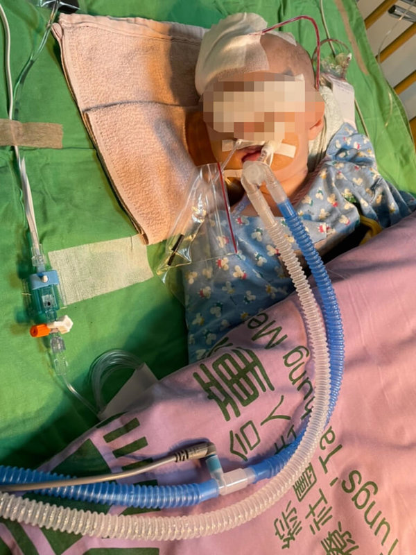 台中市剛滿1歲的女嬰送托3個月，8日保母開車送醫發現顱內出血，術後仍在加護病房觀察昏迷中。（家長提供）中央社記者趙麗妍傳真  111年11月18日