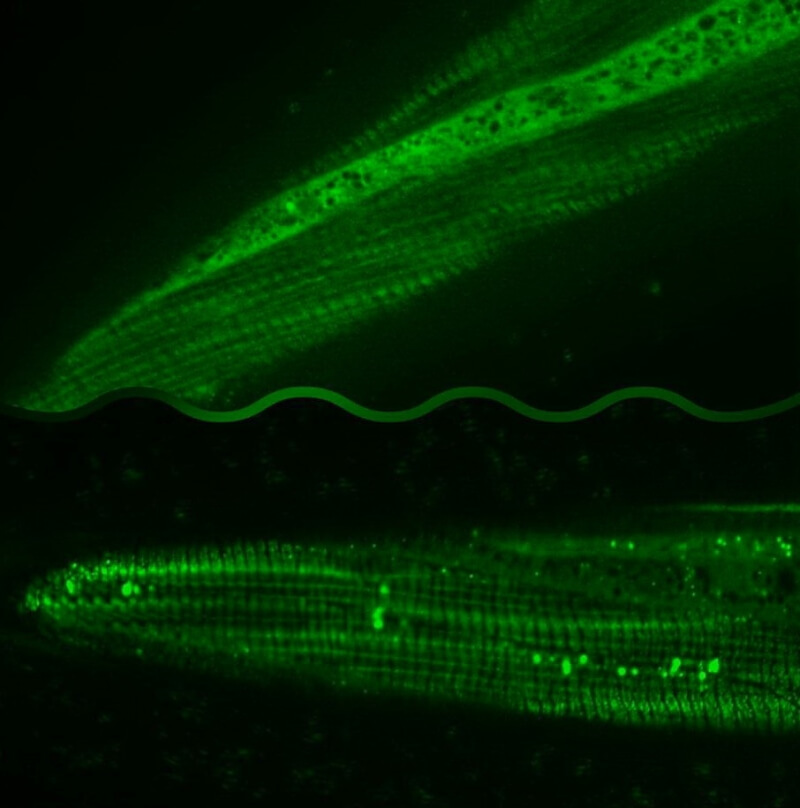 上圖為正常飲食下線蟲的自噬體（綠色光點）較少；下圖為飲食限制可以增強線蟲的自噬體（綠色光點）。（圖取自陽明交大網頁nycu.edu.tw）