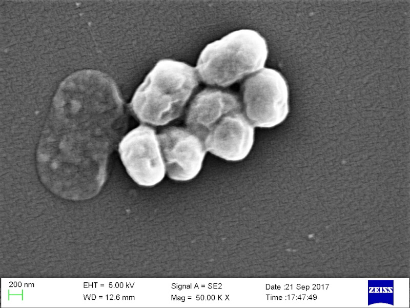 圖為電子顯微鏡下的鮑氏不動桿菌。（圖取自維基共享資源；作者：Vader1941，CC BY-SA 4.0）