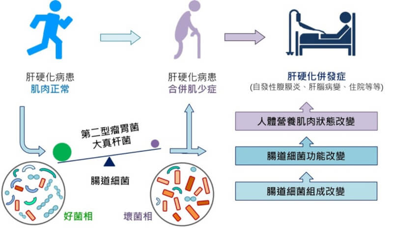 台北榮總團隊研究發現，肝硬化病人腸道細菌的組成若缺乏特定細菌，肌少症發生率較高，且會影響併發症、感染症和住院機率。（北榮提供）中央社記者曾以寧傳真 112年10月19日