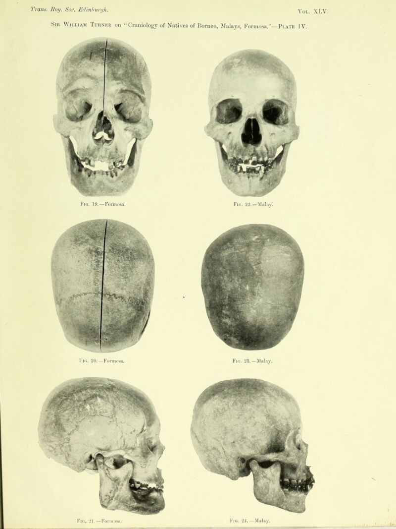 圖為英國學者透納1907年發表的著作，其中編號19到21為來自台灣的頭骨，據信是牡丹社事件排灣族勇士的骨骸。（圖取自英國Wellcome Collection網站，英國皇家外科醫學院提供）