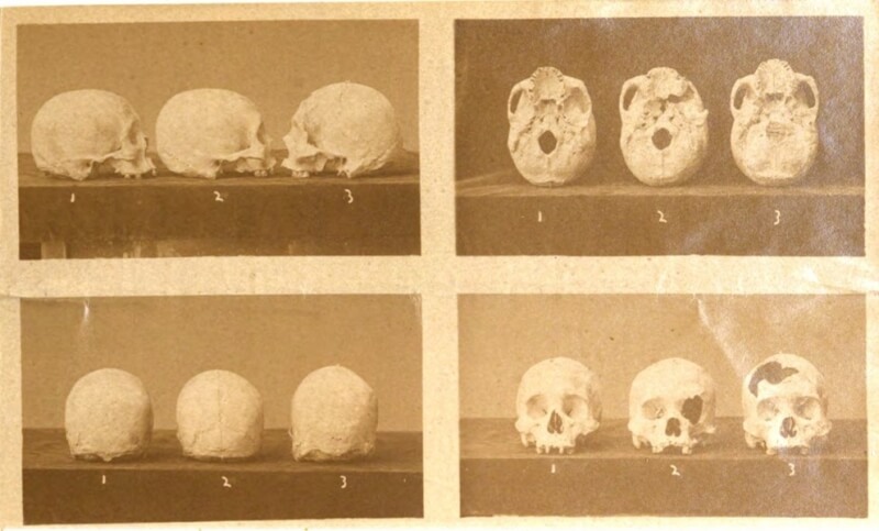 美國學者Stuart Eldridge於1877年發表「福爾摩沙牡丹人顱骨筆記」（Notes on the crania of the Botans of Formosa），當中記載來自牡丹社的4具骨骸。（圖版權屬公有領域）