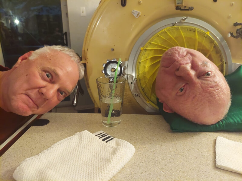 亞歷山大（右）因罹患小兒麻痺症終生癱瘓，生活在負壓呼吸機「鐵肺」裡70年。圖為亞歷山大與弟弟合照。（圖取自facebook.com/philip.alexander1）