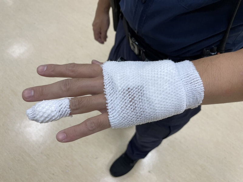 台中市豐原警分局員警8日晚間追緝失竊自小客車,遭犯嫌開車衝撞,造成員警手腳多處擦挫傷。(民眾提供)中央社記者趙麗妍傳真 113年7月9日
