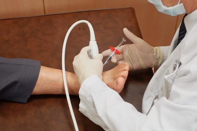 高濃度血小板血漿(Platelet-rich plasma,PRP)注射療法流程抽取自身血液約10至15cc,經離心後抽取上層的血小板血漿,透過超音波導引注射病人患部組織。(台中慈濟醫院提供)中央社記者趙麗妍傳真 113年8月12日