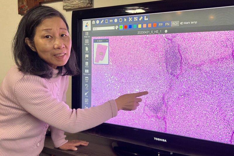 成功大學電機工程學系特聘教授詹寶珠團隊以4年時間研發醫療器材軟體「成功大學數位病理影像平台」，取得衛福部醫療器材許可證。（成功大學提供）中央社記者張榮祥台南傳真  114年1月3日