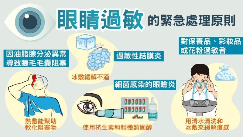 振興醫院眼科部一般眼科主任許粹剛說明，過敏性結膜炎可透過冰敷緩解不適；保持眼部清潔，可以1比1的比率，用水稀釋嬰兒洗髮精，清洗睫毛根部，一天清潔一、兩次，以改善毛囊口的阻塞。（振興醫院提供）中央社記者曾以寧傳真 114年3月13日