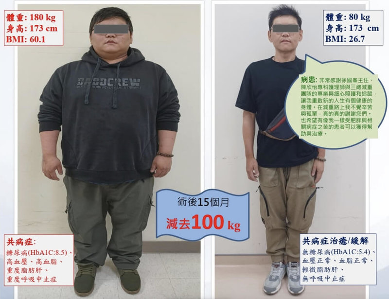 一名30歲男性上班族體重達180公斤，三高等慢性病纏身，經生活調整與減重手術，體重降至80公斤，身體質量指數（BMI）改善至26.7，多項共病症狀幾乎完全緩解，恢復健康生活。（三軍總醫院提供） 中央社記者陳婕翎傳真  114年4月23日