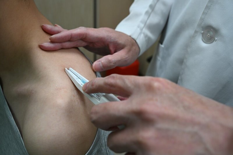 亞洲大學附屬醫院中醫師吳俊昌說，門診出現許多年輕病患出現烏龜頸、富貴包等症狀，可採浮針治療改善頸部不適。（亞大附醫提供）中央社記者趙麗妍傳真 114年5月20日