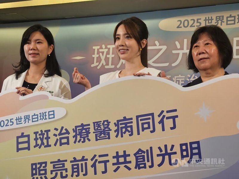 藝人愛雅(中)受邀擔任白斑症公益疾病大使,她5日分享曾在工作場合遇過白斑症朋友,當時因不了解,未多加關心,現在想起仍感遺憾。中央社記者陳婕翎攝 114年6月5日