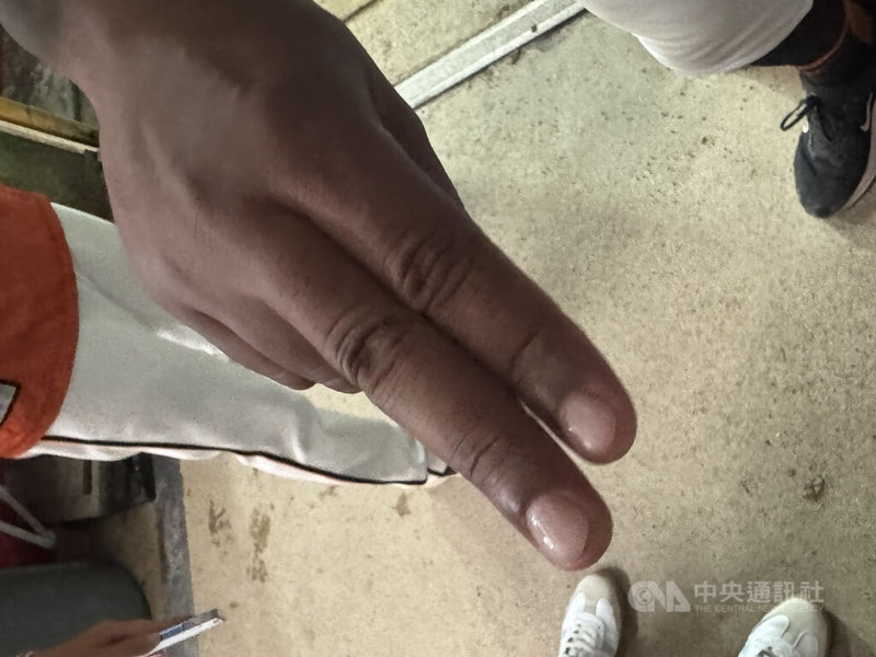 中華職棒統一獅隊洋投飛力獅嘗試以指甲光療改善投球投到手指破皮流血的問題,7日收到好效果,先發7局無失分率隊拿勝。飛力獅賽後表示,往後每2週就會做一次。中央社記者楊啟芳攝 114年6月7日