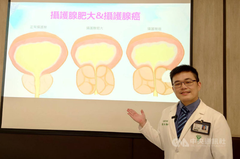 奇美醫院泌尿外科主治醫師曾文歆(圖)24日在院內衛教宣導會表示,攝護腺癌最可怕是太晚發現,若未提高警覺,確診時往往已進展到較晚期。中央社記者楊思瑞攝 114年6月24日