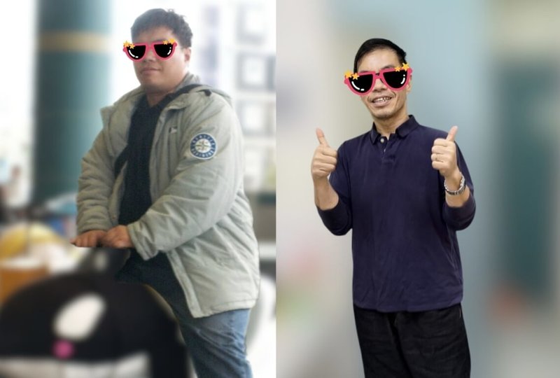 高雄1對長期受到肥胖困擾的夫妻,經高雄市立小港醫院評估採取「內視鏡袖狀胃成形術」後,俗稱「無痕胃拉提」,共減去50公斤,也改善高血壓、代謝異常、膝關節疼痛等體重過重衍生的健康狀況,找回健康與生活主控權。(高雄市立小港醫院提供)中央社記者林巧璉傳真 114年7月8日