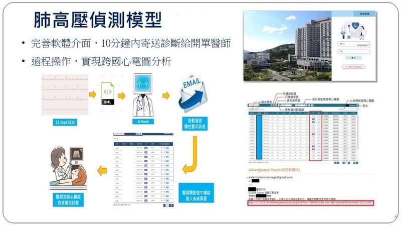 台北榮總聯手多個醫療及研究機構,研發完成全球首款跨國、跨中心驗證的「心電圖肺高壓偵測系統」,有助篩檢死亡率高的疾病「肺高壓」,且診斷效能顯著優於傳統醫師。(台北榮總提供)中央社記者曾以寧傳真 114年7月10日