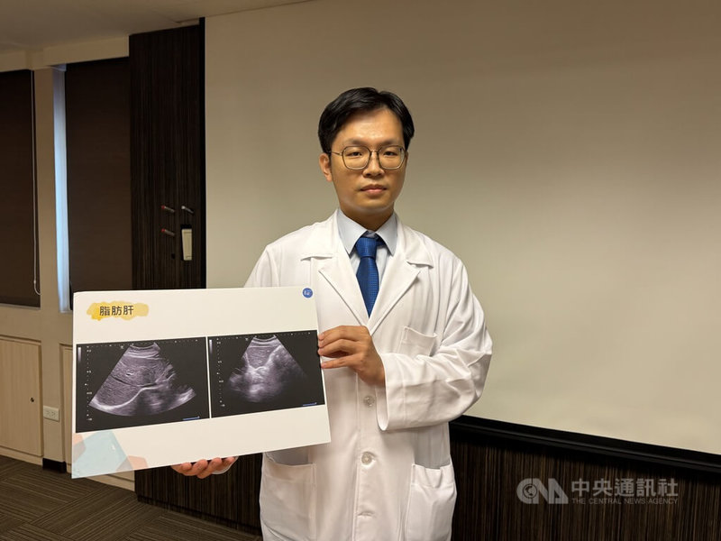 書田診所胃腸肝膽科主任醫師康本初(圖)22日在衛教記者會中提醒,有患者天天喝酒導致血球變大顆的貧血,發現酒精性肝病悄悄上身,呼籲酒精沒有安全量,千萬別認為不酗酒即可。中央社記者沈佩瑤攝 114年7月22日