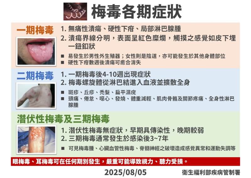 (疾管署提供)