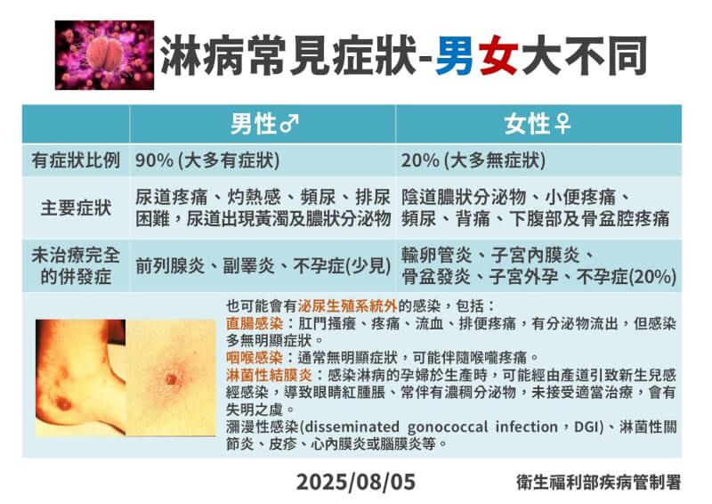 (疾管署提供)