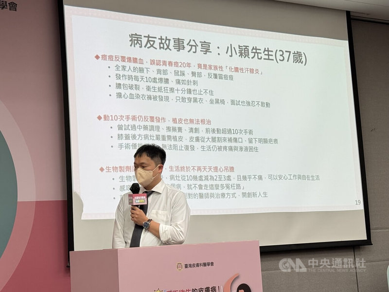 化膿性汗腺炎為自體免疫失調疾病，常會與青春痘混淆，病友小穎（圖）7日在衛教活動中現身分享經驗，盼鼓勵其他病友不要輕言放棄治療可能。中央社記者沈佩瑤攝　114年8月7日