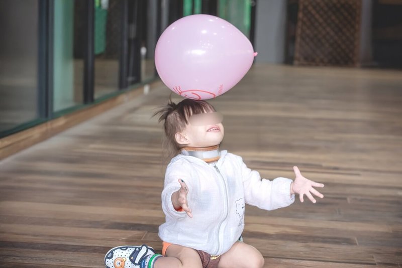 腭裂合併多重病症女孩萁萁(圖)出生時一度被宣判僅能活7天,但在各方努力下,她順利成長到4歲,成為個性開朗、總是用燦爛笑容與人互動的小女孩。(羅慧夫顱顏基金會提供)中央社記者曾以寧攝 114年8月15日