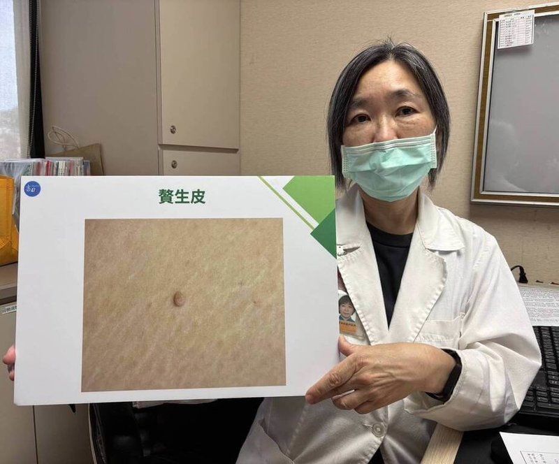 書田診所整形美容科主任醫師黃季怡（圖）說，贅生皮紅腫疼痛建議積極治療，以免引起併發症或留下疤痕，發現身上有凸起物、腫塊，最好就醫檢查確認病因。 （書田診所提供） 中央社記者陳婕翎傳真 114年8月20日