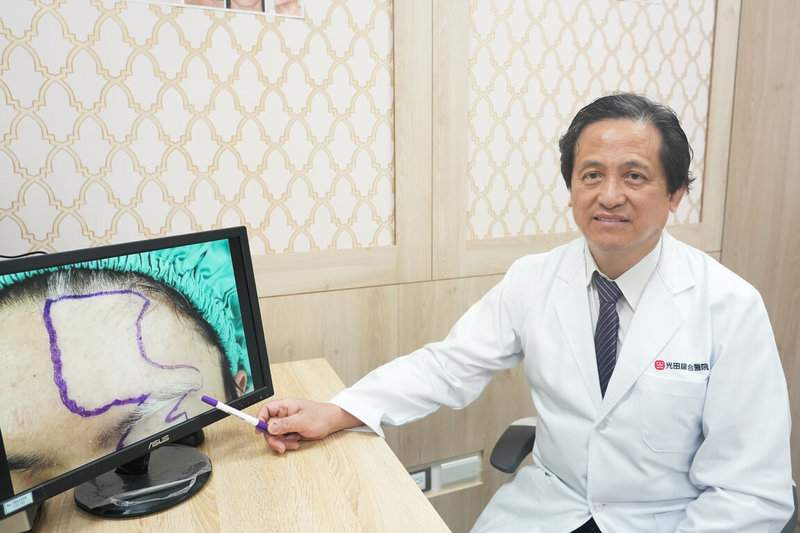 光田綜合醫院整形外科主任吳文宏指出,王男左額膚色越來越淡,以為曬太陽可改善,未料更加明顯;吳文宏說,白斑症是因免疫系統異常,導致黑色素細胞受損或缺失的疾病,以「黑色素顯微移植」方式可改善。(光田綜合醫院提供)中央社記者趙麗妍傳真 114年9月22日