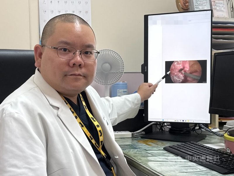 李綜合醫院泌尿科主治醫師黃品叡1日指出,民眾如果長期憋尿,有出現頻尿、急尿、排尿疼痛或下腹痛等症狀,建議儘快就醫。中央社記者趙麗妍攝 114年10月1日