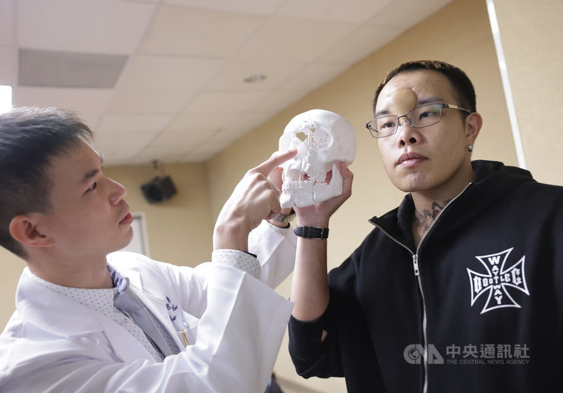 三軍總醫院26日在內湖院區舉行「從碎裂到重生,3D列印顱顏重建」記者會,整形外科主治醫師徐國峰(左)與顱顏重建患者(右)說明醫療團隊如何結合3D列印輔助導航技術與跨專科整合治療,重建因槍傷導致缺損的額鼻骨、下顎等結構,完成高難度顱顏重建手術。中央社記者裴禛攝 114年11月26日