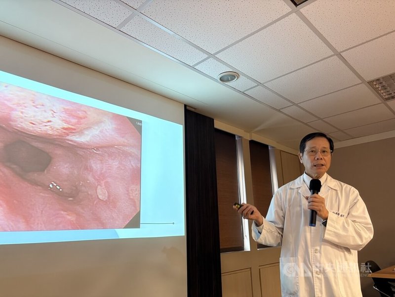 書田診所胃腸肝膽科主任醫師邱展賢28日在衛教記者會分享，自己曾診治多名因服用保健食品或藥物方式不對，導致食道潰瘍或胃潰瘍的患者，提醒民眾服用時要注意。中央社記者曾以寧攝　114年11月28日