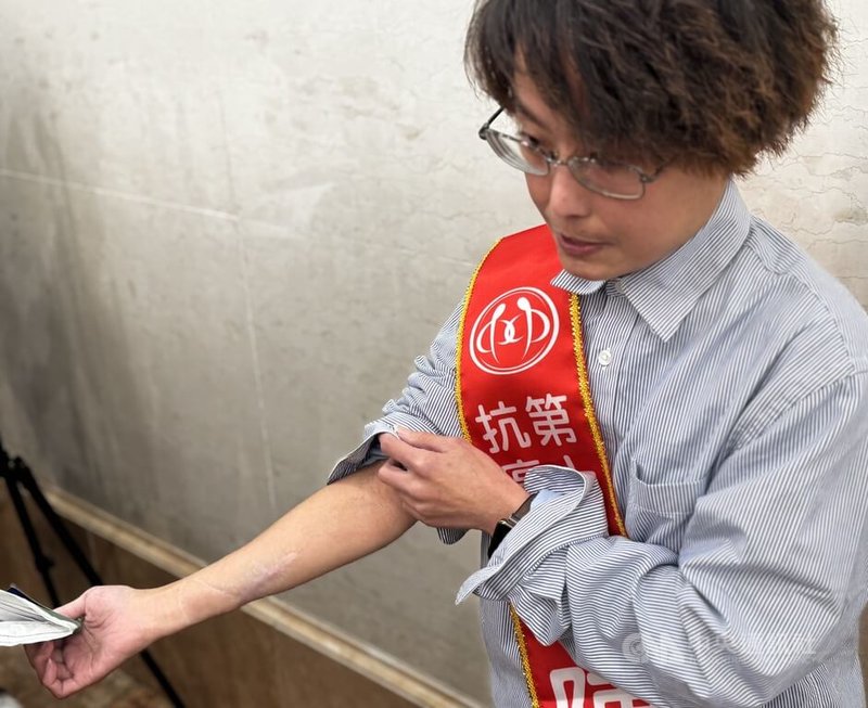 台灣癌症基金會29日舉辦「第19屆十大抗癌鬥士頒獎典禮」，得獎者之一、跆拳道好手陳億婷（圖）秀出手上手術治療所留疤痕分享自身故事，勇奪2025世壯運銀牌的她，用生命證明「我沒有被打倒」。中央社記者沈佩瑤攝　114年11月29日