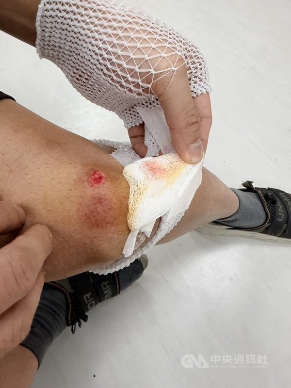 傷害罪通緝犯何姓男子30日在台北市敦化南路一帶遇警盤查、趁機逃逸，警方於追捕過程中受傷，所幸最後仍順利逮捕何男，詢後解送歸案。（翻攝照片）中央社記者黃麗芸傳真　114年11月30日