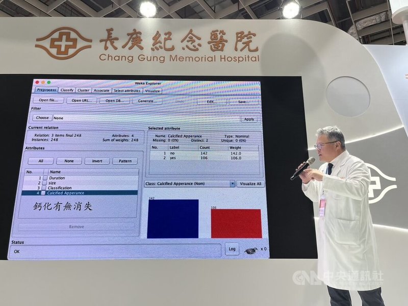 高雄長庚醫院骨科部運動醫學科醫師周文毅5日在成果發表記者會表示,研究團隊透過AI輔助分析,預測患者對體外震波治療反應,為全球首篇以人工智慧預測體外震波治療肩鈣化性肌腱炎療效的研究,登上國際期刊。中央社記者曾以寧攝 114年12月5日