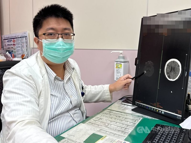 一名婦人眼睛突然模糊，就醫發現右側中大腦動脈阻塞而影響視野。李綜合醫院神經內科醫師張峻誠（圖）指出，非典型中風指中風症狀不是臉歪嘴斜、單側無力或口齒不清，而是出現如婦人般，有突然視野缺損或視力模糊，還可能出現突然頭暈合併平衡感喪失、認知功能障礙、意識改變，或是單側肢體不自主運動等，症狀出現越早送醫，治療效果越好。中央社記者趙麗妍攝　114年12月11日