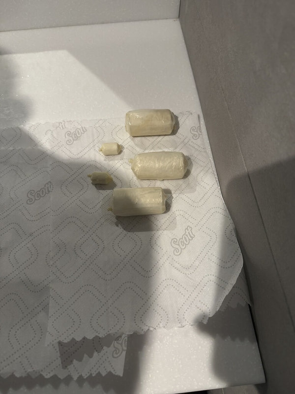 海巡署偵防分署台中查緝隊9月在高雄小港機場查獲2名泰國籍女子,吞食海洛英毒品以人體夾帶方式走私,後到醫院排出多達115顆毒品膠囊。(民眾提供)中央社記者趙麗妍傳真 114年12月11日