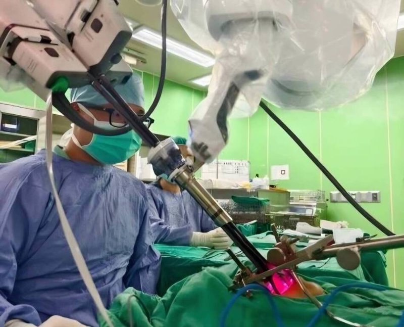 林口長庚採用「單孔達文西內外複合喉保留手術」，幫助罹患少見的咽喉小唾腺癌患者，讓病人抗癌不失聲。（長庚醫院提供）中央社記者陳婕翎傳真　114年12月11日