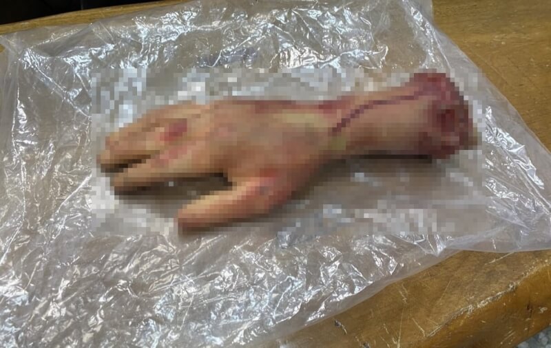 台中市大里區德芳路上出現一隻遭砍斷掌，經員警查看是玩具假手，但因假手上畫有血跡，且樣貌逼真，驚嚇到過路民眾。（民眾提供）中央社記者趙麗妍傳真　114年12月15日