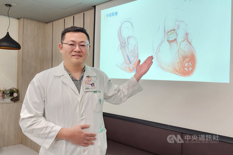 奇美醫院心臟血管外科主任吳南鈞（圖）21日在院內衛教宣導會表示，治療主動脈瓣逆流可採新型微創手術，但應與醫師充分討論並決定適當治療方式。中央社記者楊思瑞攝　115年1月21日