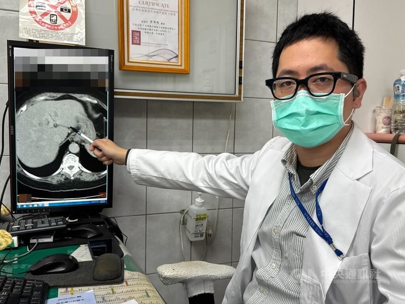 李綜合醫院外科醫師吳坤達說，一名患者嗜吃甜食導致罹患重度脂肪肝，呼籲民眾注意均衡營養、控制飲食，養成運動習慣，才能減少脂肪肝的形成。中央社記者趙麗妍攝　115年1月22日