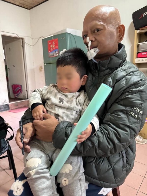45歲長年在工地工作的阿福（化名），曾罹患口腔癌4期，治療後7年他迎來么子出生，癌症卻復發，只能切去大片臉部病灶、靠鼻胃管進食，但他仍告訴自己要活下去，盼陪年幼的子女長大。（陽光基金會提供）中央社記者曾以寧傳真　115年2月11日