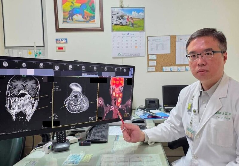 大千醫院放射腫瘤科主任張富迪表示，鼻咽癌在台灣相當常見，據衛福部國健署公布最新資料，台灣每年有逾1400名鼻咽癌新診斷病人，其中超過4成因為發現時機較晚而未能治癒；持續性耳鳴或頸部腫塊都是警訊，早期發現、早期治療絕對是關鍵。（大千醫院提供）中央社記者管瑞平傳真　115年2月27日