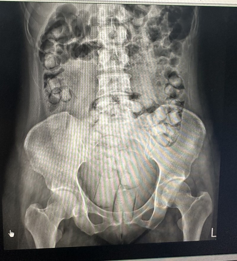 海巡署偵防分署台中查緝隊114年9月在高雄小港機場查獲2名泰國籍女子，吞食海洛因毒品以人體夾帶方式走私。（民眾提供）