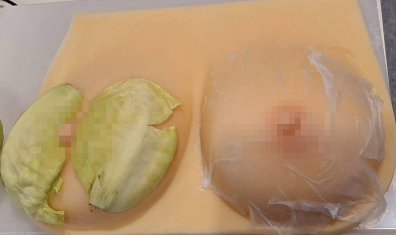 第51屆瑞士日內瓦發明展獲得雙金牌 「含有蘿蔔硫素的複合纖維基材」作品，為臺北榮民總醫院護理長廖淑貞團隊所研發的胸膜。（台灣發明協會提供）中央社記者郭芳君蘇黎世傳真　115年3月17日