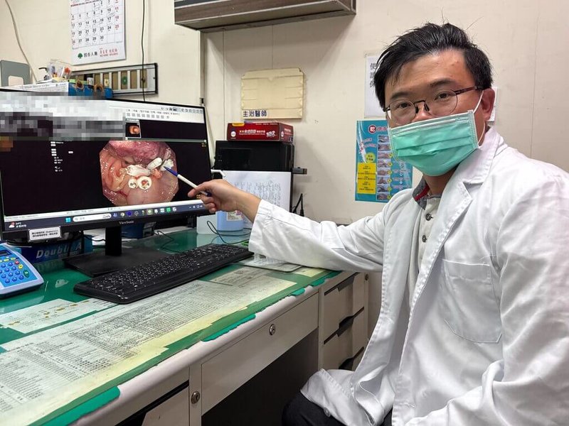 一名60歲男子家人有大腸癌病史卻輕忽，日前首度接受篩檢就查出大腸內有6顆腫瘤。駐診苗栗苑裡李綜合醫院的台中榮總肝膽腸胃科主治醫師吳彥穎（圖）16日分享個案，提醒民眾勿輕忽大腸癌家族病史風險。（苑裡李綜合醫院提供）中央社記者管瑞平傳真　115年4月16日