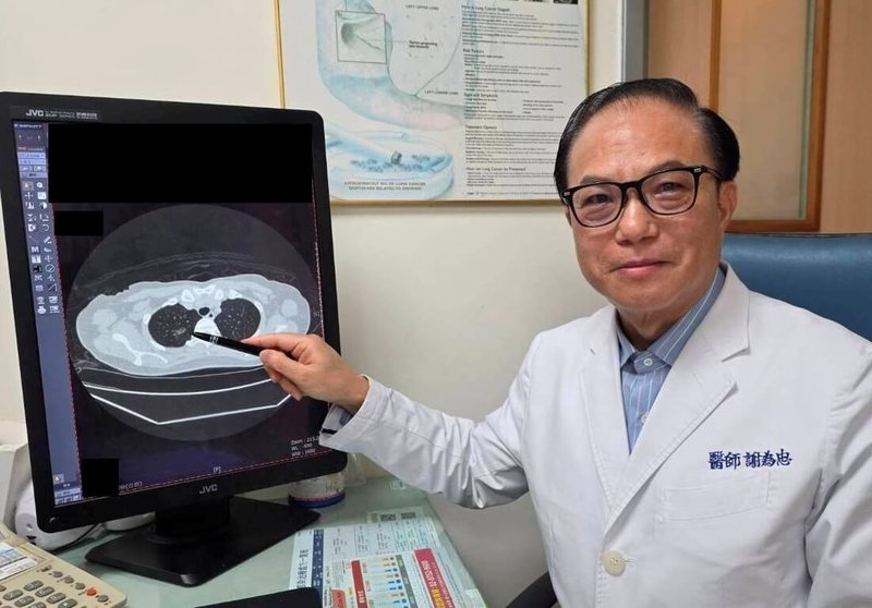 苗栗縣56歲人婦長期咳嗽不見好轉，就醫透過低劑量電腦斷層（LDCT）揪出早期肺癌，經微創手術治療後恢復良好。大千綜合醫院醫師謝為忠（圖）提醒，高風險族群可多利用政府提供每2年1次的公費LDCT篩檢。（大千醫院提供）中央社記者管瑞平傳真　115年4月22日