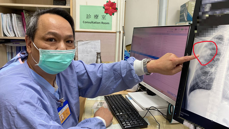 員榮醫院醫師王胤德（圖）說，45歲患者到日本旅遊返台出現畏寒、咳嗽等症狀就醫，經檢查診斷為肺膿瘍合併肺炎；醫師提醒，肺膿瘍延誤治療可能引發敗血症，嚴重恐致死。（員榮醫院提供）中央社記者鄭維真傳真　115年5月8日