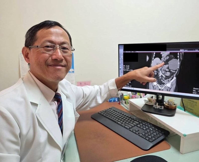 苗栗縣85歲婦人就診查出橫結腸脫位竄入左側胸腔。大千綜合醫院外科部主任馮啟彥（圖）19日說，橫膈膜疝氣多由外傷壓力引起，婦人完全沒有外傷史的「自發性橫膈膜疝氣」，在臨床上非常罕見。（大千醫院提供）中央社記者管瑞平傳真　115年5月19日