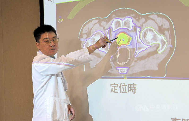 有「熟男隱形殺手」之稱的攝護腺癌對男性威脅正持續擴大，三軍總醫院放射腫瘤部主治醫師楊仁富（圖）27日分享個案病例並指出，攝護腺癌治療已邁入即時影像精準醫療新時代。中央社記者陳婕翎攝　115年5月27日